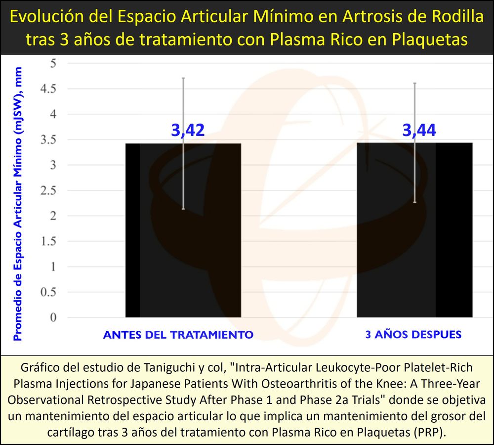 Detención de la degeneración del cartílago en artrosis de rodilla, mediante tratamiento con Plasma Rico en Plaquetas (PRP)