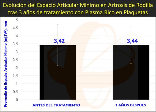 https://www.sendagrup.com/2024/08/28/detencion-de-la-degeneracion-del-cartilago-en-artrosis-de-rodilla-mediante-tratamiento-con-plasma-rico-en-plaquetas-prp/