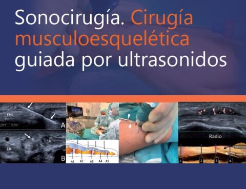 "Sonocirugía. Cirugía musculoesquelética guiada por ultrasonidos", nuevo libro dirigido por el Dr. Javier De la Fuente, traumatólogo y responsable de la Unidad de Ecografía Musculoesquelética del Centro Médico Sendagrup de Donostia - San Sebastián